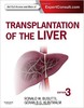 Thumbnail Transplantation of the Liver Thumbnail Transplantation of the Liver