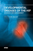Thumbnail Developmental Diseases of the Hip Thumbnail Developmental Diseases of the Hip