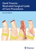 Thumbnail Hand Trauma - Illustrated Surgical Guide of Core Procedures