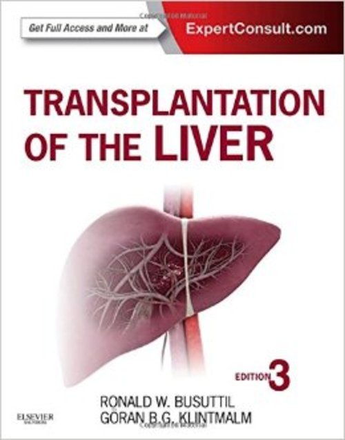 Product picture Transplantation of the Liver