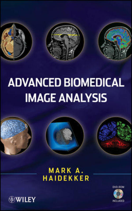 Product picture Advanced Biomedical Image Analysis