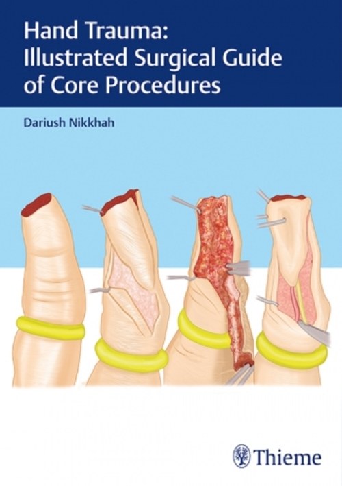Product picture Hand Trauma - Illustrated Surgical Guide of Core Procedures